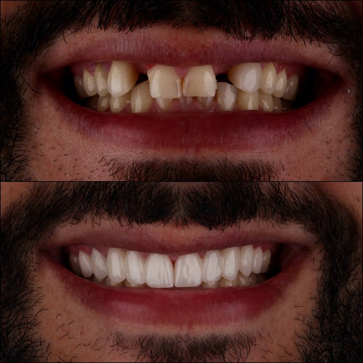 Collage_Fotorjj