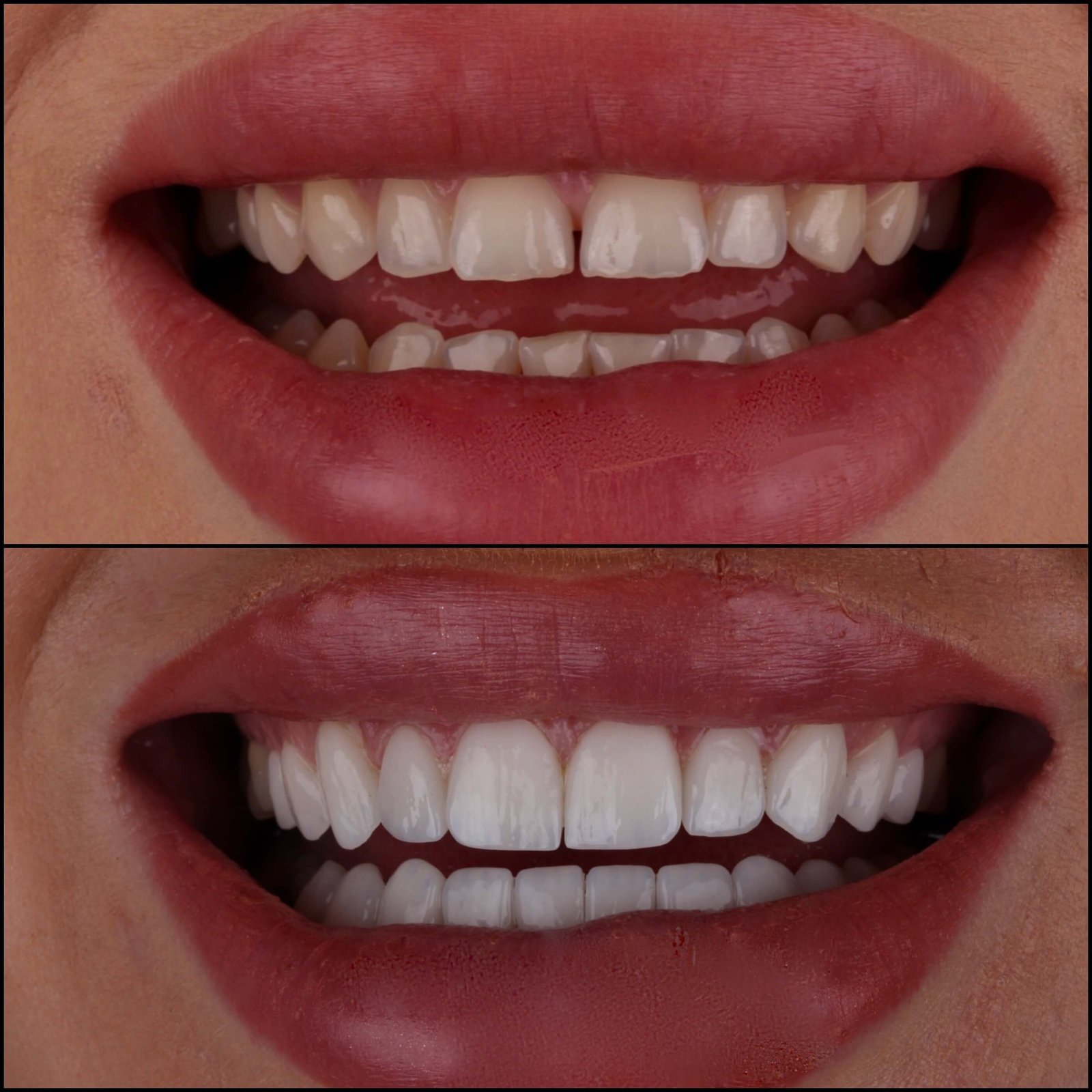 Collage_Fotottr(1)