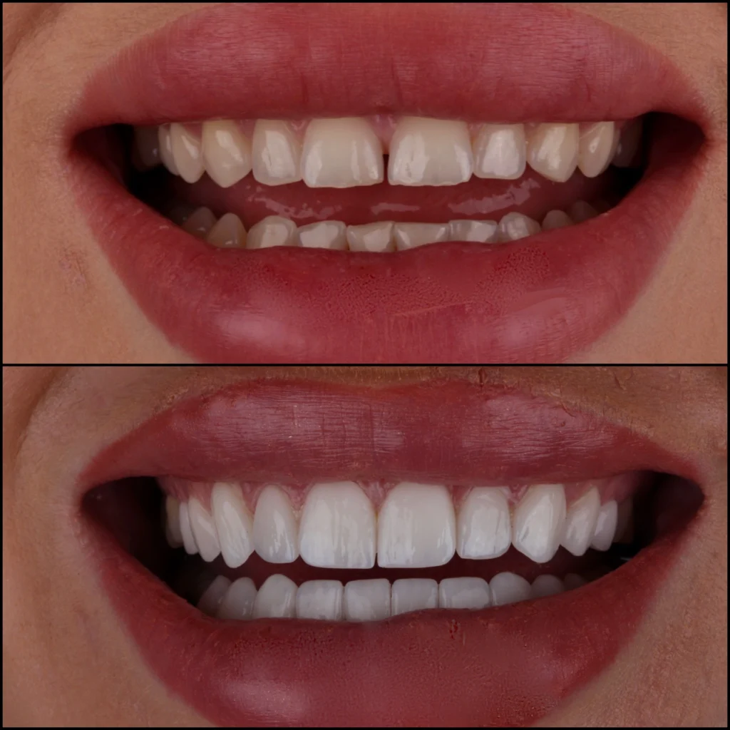 dental care center Heliopolis