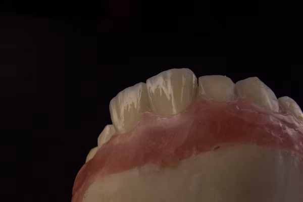 شكل الطربوش للاسنان