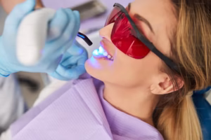 تبييض الاسنان بالليزر في التجمع الخامس