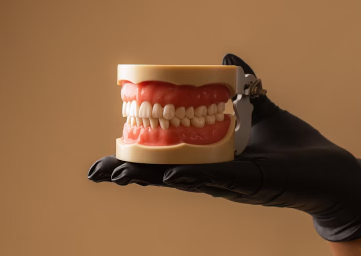 حشو الكمبوزيت