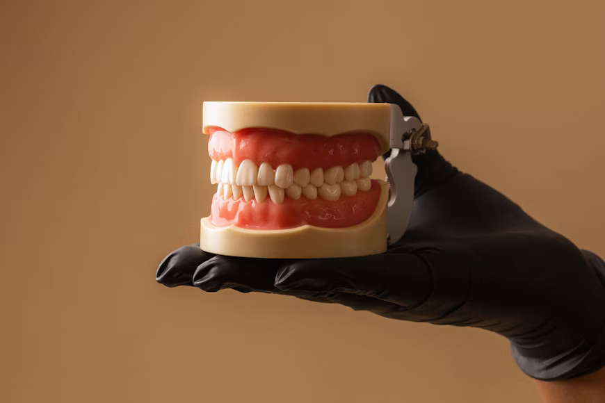 حشو الكمبوزيت