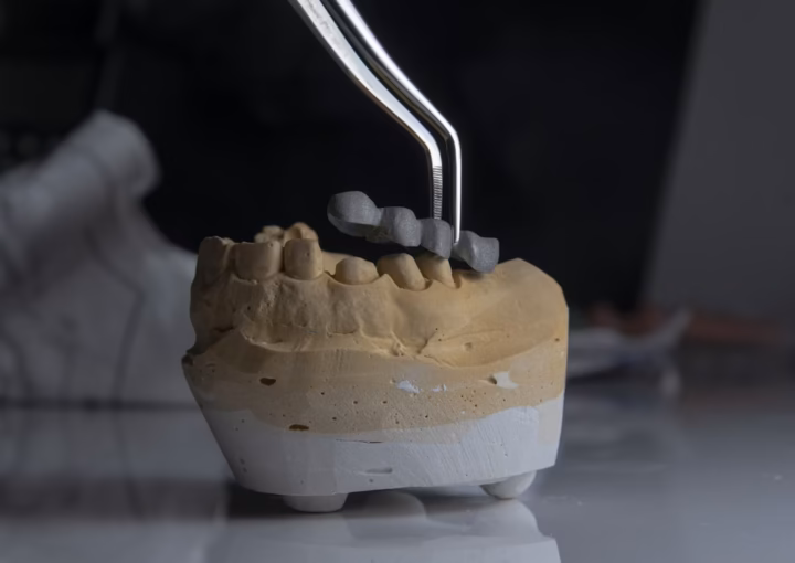what material are dental implants made of