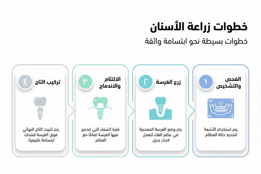 مراحل زراعة الأسنان بالصور خطوة بخطوة