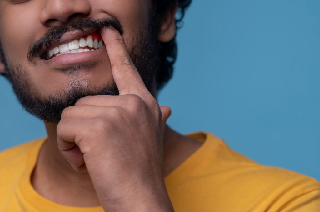 التهاب عصب الأسنان