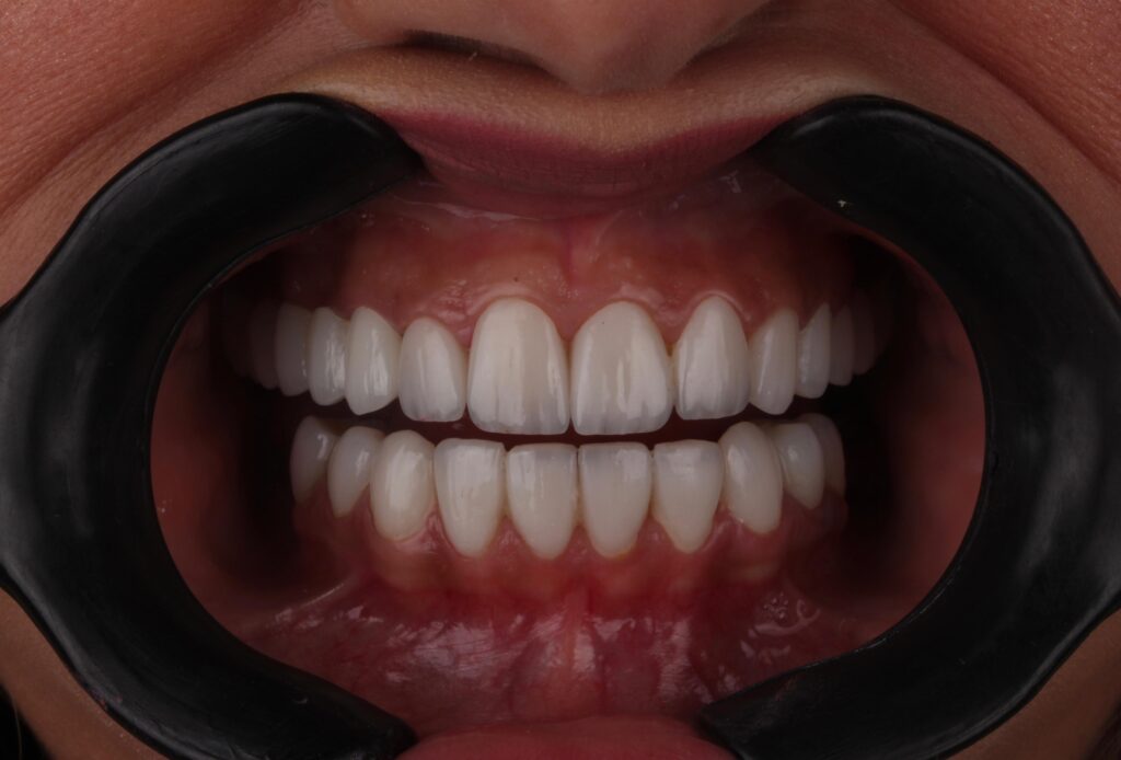 cosmetic in dentistry