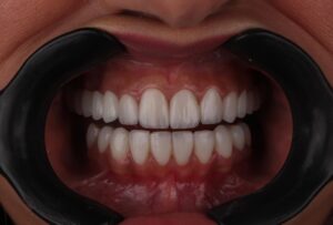 cosmetic in dentistry