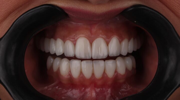 cosmetic in dentistry