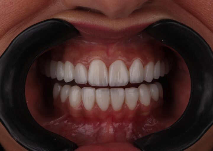 cosmetic in dentistry
