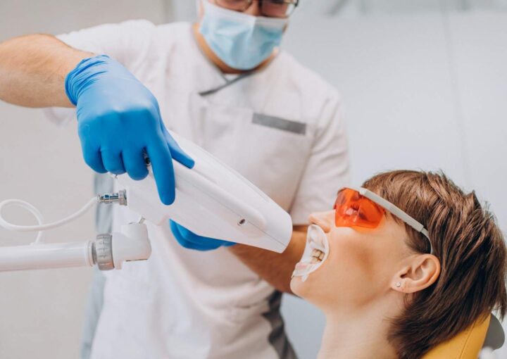 dental bleaching