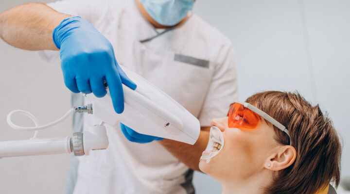 dental bleaching