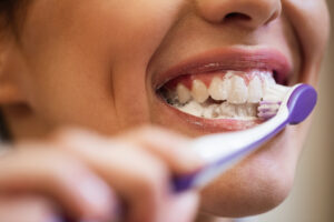 teeth cleaning