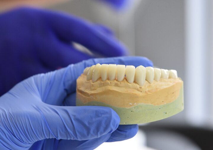 E-Max Dental Crown